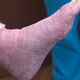 Image for article titled Bada Bing, Dr. Pimple Popper Meets Bada Boob